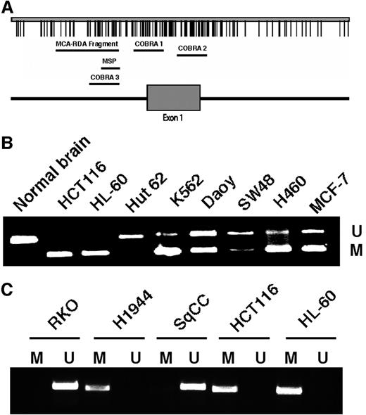 Fig. 1. Tazarotene-induced gene 1 (TIG1) map and methylation in cancer cells. A, CpG map of the TIG1 promoter (GenBank accession number XM_003103). The location of exon 1 is indicated below the map. Of note is the DNA fragment generated with methylated CpG amplification-representation difference analysis and its location, which is very close to exon 1 of the gene. The areas of the promoter analyzed by combined bisulfite restriction analysis (COBRA) and methylation-specific PCR (MSP) are also indicated. B, methylation analysis of the promoter region in selected cell lines (indicated at the top of each lane) by combined bisulfite restriction analysis. The PCR products from methylated cell lines were digested with the restriction enzyme HinfI, giving rise to two bands: the upper unmethylated DNA populations (U) and the lower methylated DNA populations (M). HinfI was unable to digest the products from the unmethylated cell lines, giving rise to a single discrete 221-bp band. C, methylation-specific PCR analysis of selected cell lines. U and M represent the unmethylated and methylated fragments generated by the respective primers.