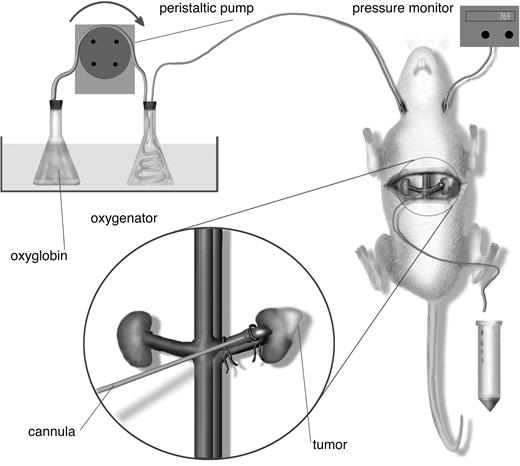 Fig. 1. Schematic drawing of the kidney-isolated tumor model. Perfusion is maintained through cannulation of the right jugular vein. The right carotid artery is connected with a pressure transducer. The renal vein is cannulated, and the perfusion solution is collected. The inset displays the tumor growing in the kidney.