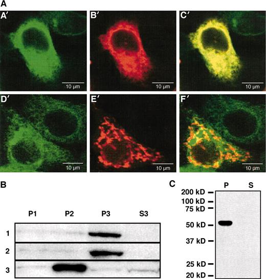 Fig. 6. Subcellular localization of CYP4Z1 in MCF-7 cells. A, MCF-7 cells were transiently cotransfected either with vectors pCYP4Z1-EGFP and pmRFP1-endoplasmic reticulum (A′-C′) or pCYP4Z1-EGFP and pmRFP1-Mito (D′-F′). Twenty-four h after transfection, cells were fixed with paraformaldehyde and examined by confocal laser-scanning microscopy. Representative cells are illustrated. The following expressed fluorescent proteins were detected with filter sets described in “Materials and Methods”: CYP4Z1-EGFP (A′ and D′); mRFP1-Sec61 β subunit (B′); mRFP1-Mito (E′); C′ and F′ are superimposed images of A′ and B′ or D′ and E′, respectively. B, subcellular fractionation of MCF-7 cells transduced with CYP4Z1. Equal volumes of fraction P1 (nuclei and debri), P2 (mitochondria), and P3 (microsomes) and an equivalent volume of S3 (soluble proteins) were subjected to SDS-PAGE and immunoblot analysis for direct comparison of signal intensity. Immunostainings were performed with primary antibodies against CYP4Z1 (1), calnexin (2), or HSP60 (3). C, distribution of CYP4Z1 after alkaline sodium carbonate extraction of extrinsic proteins from endoplasmic reticulum membranes. Equivalent volumes of pellet (P) and supernatant (S) after ultracentrifugation were subjected to immunoblot analysis. EGFP, enhanced green fluorescent protein; mRFP1, monomeric red fluorescent protein 1.