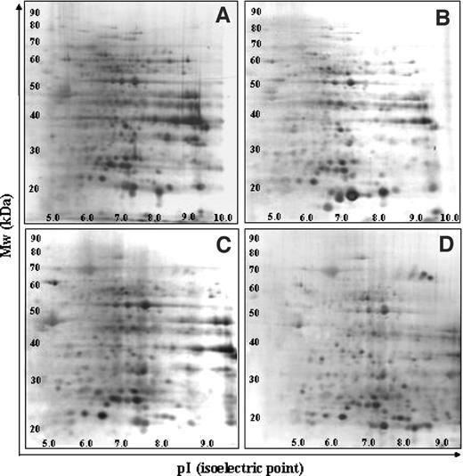 Fig. 1. Representative two-dimensional electrophoresis gels of each histological type. A, normal brain tissue; B, astrocytoma; C, anaplastic astrocytoma; D, glioblastoma multiforme. After isoelectric focusing for the first dimension of protein separation, the gel strips were electrophoresed in vertical SDS-PAGE slab gels and then stained with silver. Although the basic spot distribution patterns are similar among various histological grades, many protein spots were differentially expressed. Mw, molecular weight.