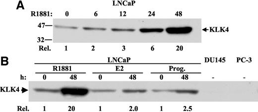 Fig. 2. Expression and regulation of hK4 protein in prostate cancer cells. A, LNCaP cells were either left untreated or treated with R1881 (10−8 m) for indicated times, and whole cell extracts were prepared. hK4 expression was assessed by Western analysis. The position of the 32 and 45 kDa markers is shown (left). Migration position of hK4 is indicated (arrow to the right). Results shown are from an experiment repeated three times with consistent results. Relative induction (Rel.) of hK4 protein accumulation (with LNCaP at t = 0 set as 1) is indicated at the bottom of the lanes and was determined by densitometry. B, LNCaP cells were either left untreated or treated with R1881 (10−8 m), estradiol (E2, 10−8 m), and progesterone (Prog., 10−8 m) for 48 h, followed by preparation of whole cell extracts. Whole cell extracts from DU145 and PC-3 cells were analyzed in parallel; Rel. of hK4 protein accumulation (with LNCaP at t = 0 set as 1) is indicated (bottom of lanes) and was determined by densitometry.