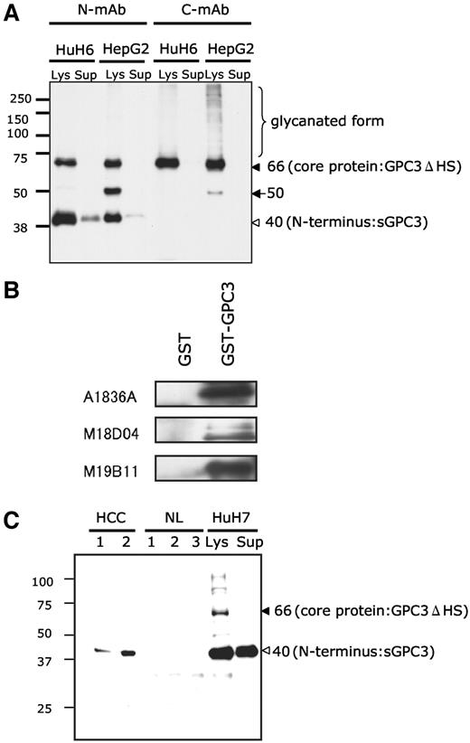 Fig. 2. Characterization of endogenous glypican-3 (GPC3) proteins with monoclonal antibodies (mAbs). A, representative immunoblotting of endogenous GPC3 in the cell lysate and culture supernatant with N-mAb and C-mAb. HepG2 and HuH6 were analyzed. Note that soluble GPC3 (sGPC3) alone is detected in the culture supernatant. Brace, glycanated GPC3 (smearing); closed arrowhead, core protein of GPC3 (Mr 66,000); open arrowhead, sGPC3 (Mr 40,000); arrow, uncharacterized processed fragment of GPC3 (Mr 50,000). Lys, lysate; Sup, supernatant of culture media. B, immunoblotting analysis with anti-GPC3 antibodies A1836A, M18D04, and M19B11 recognized glutathione S-transferase-sGPC3 but did not recognize glutathione S-transferase. C, detection of sGPC3 alone in the sera of the patients with hepatocellular carcinoma. Sera from two patients with hepatocellular carcinoma and three healthy adults (NL) were analyzed by immunoprecipitation with M18D04 followed by immunoblotting with A1836A. HuH7 cells were analyzed as a reference. Closed arrowhead, core protein of GPC3 (Mr 66,000); open arrowhead, sGPC3 (Mr 40,000).