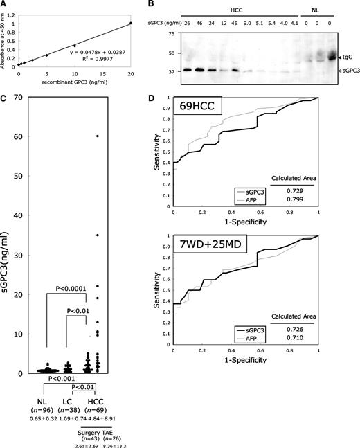 Fig. 3. Evaluation of soluble glypican-3 (sGPC3) as a serological marker of hepatocellular carcinoma (HCC). A, standard curve of sandwich ELISA. B, high specificity of sandwich ELISA. Specific detection of sGPC3 alone solely in the sera with elevated sGPC3 level measured with sandwich ELISA. Sera from 10 patients with HCC and 3 healthy adults (NL) were analyzed by immunoprecipitation with M18D04 followed by immunoblotting with A1836A. Serum sGPC3 level is indicated for each sample. Open arrowhead, sGPC3 (Mr 40,000); closed arrowhead, IgG. C, distribution of sGPC3 in the sera of patients with normal liver, liver cirrhosis (LC), and HCC (surgery and transcatheter arterial chemoembolization subgroup). Mean ± SD (ng/ml) of serum sGPC3 is indicated. Number of samples is indicated as n. D, receiver-operating characteristic curve analysis of sGPC3 (thick line) and α-fetoprotein (thin line). Top panel, all of the 69 HCCs and 38 cases of LC were included in the analysis. Bottom panel, 32 HCCs (including 7 well-differentiated and 25 moderately differentiated HCCs) and 38 cases of LC were analyzed. Area under the receiver-operating characteristic curve is indicated.
