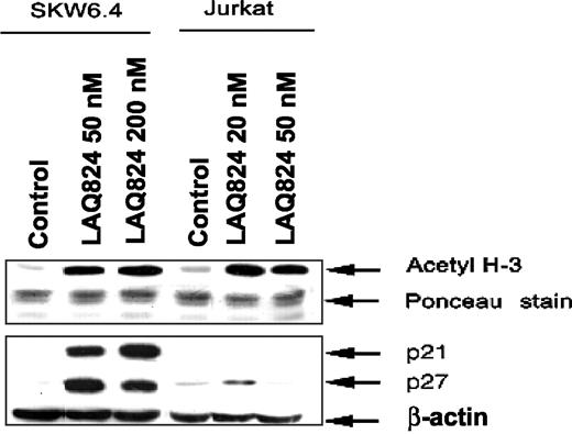 Fig. 1. LAQ824 induces histone acetylation and levels of p21 and p27. SKW6.4 and Jurkat cells were treated with LAQ824 at the indicated concentrations for 24 h. After the isolation of histones, Ac-histone H3 acetylation was detected by Western blot analysis using the antiacetylated Ac-histone H3 antibody. Total cell lysates were also probed with anti-p21 and anti-p27 antibodies. β-Actin levels served as the control for protein loading.