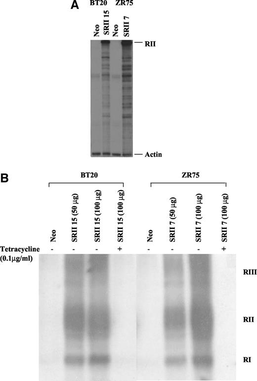 Fig. 1. Transforming growth factor-β receptor type II (RII) mRNA, and cell-surface receptor expression in BT20 and ZR75 transfectants. A, typical limiting dilution clones of BT20 and ZR75 were stably transfected with a tetracycline regulatable RII expression vector and selected in geneticin. The stable clones (designated SRII 15 and SRII 7) were compared with the Neo transfection controls for RII mRNA levels by RNase protection assay. Transfected RII mRNA levels are shown. Actin mRNA levels was used for normalization of sample loading. B, receptor cross-linking assays were used to verify cell surface expression of RII. Confluent monolayer cultures of BT20 NEO, ZR75 Neo, and their RII transfectants were incubated with 200 pm 125I transforming growth factor-β1, cross-linked with 0.3 mm disulfosuccinimidyl suberate and separated by 4–10% gradient SDS-PAGE under reducing conditions. Wherever indicated, the cells were treated with 0.1 μg/ml of tetracycline to repress the RII expression and thereby demonstrated the specificity of binding.