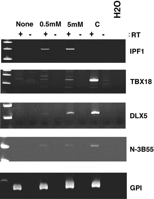 Fig. 5. Re-expression of genes silenced by DNA methylation. Reverse transcription-PCR reactions for IPF1, TBX18, DLX 5, and TBR1 in chronic lymphocytic leukemia cell line WAC3CD5, treated with 0, 0.5 and 5.0 μm of 5-aza-2′-deoxycytidine for 72 h. Expression of glucose phosphate isomerase (GPI), a housekeeping gene, was used to assess RNA integrity. Universal human reference RNA was used as a positive control for reverse transcription-PCR reactions.