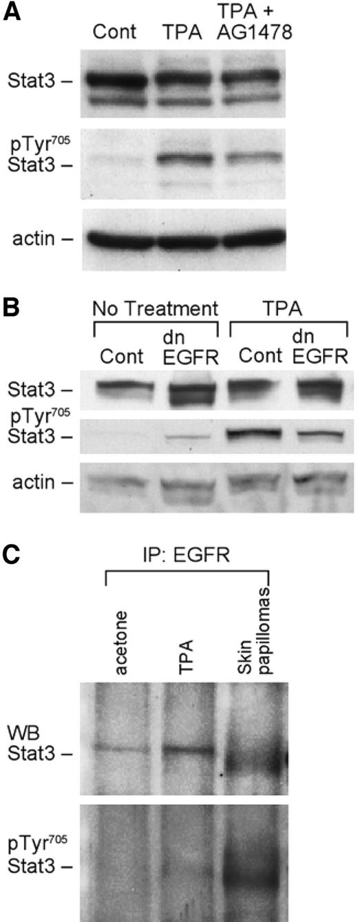 Fig. 4. Evidence for epidermal growth factor receptor (EGFR) signaling in Stat3 activation during mouse skin tumor promotion. A, groups of at least three SENCAR mice were treated with 12-O-tetradecanoylphorbol-13-acetate (TPA) in the presence and absence of the EGFR kinase-specific inhibitor AG1478. Epidermal lysates were collected 3 h after TPA treatment and subjected to Western blot analysis using Stat3 antibodies as shown. B, groups of at least three mice each [nontransgenic littermates or dominant negative EGFR (dnEGFR)] were treated with TPA, and epidermal lysates were collected 3 h after TPA treatment. Western blot analysis was performed using Stat3 antibodies as shown. C, epidermal lysates from SENCAR mice treated with TPA and lysates from papillomas were immunoprecipitated with an anti-EGFR antibody and separated by gel electrophoresis under reducing conditions. After transfer to membranes, blots were probed with an anti-Stat3 antibody.