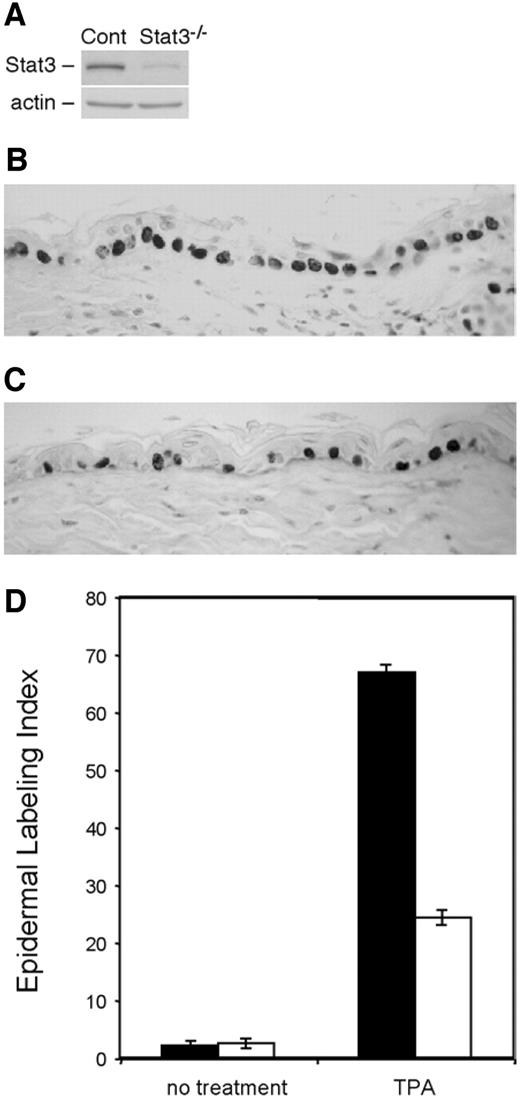 Fig. 5. Stat3 deficiency in mouse epidermis leads to a significant reduction in 12-O-tetradecanoylphorbol-13-acetate (TPA)-induced epidermal hyperproliferation. Stat3-deficient mice and control littermates were treated with a single dose of TPA. Mice were injected with 5-bromo-2′-deoxyuridine (BrdUrd) 30 min before sacrifice, and mice were sacrificed 17 h after treatment (peak of epidermal cell proliferation). A, Western blot analysis of total Stat3 protein level in epidermal lysates from Stat3-deficient and control mice. B, BrdUrd stained skin section from control littermates. C, BrdUrd stained skin section from Stat3-deficient mice. D, percentage of BrdUrd-positive cells [labeling index (LI)] in epidermis of Stat3-deficient mice compared with control littermates. LI was determined as described previously (51). (▪) represents control littermates, and (□) represents Stat3-deficient mice. The difference in the LI between control littermates and Stat3-deficient mice after TPA treatment was found to be statistically significant (P < 0.01) by the Student t test.