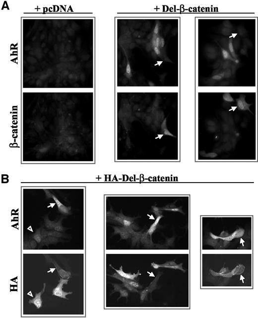 Fig. 5. Immunofluorescence staining analyses of aryl hydrocarbon receptor (AhR) expression in response to mutant β-catenin overexpression. A, CWR22-Rv1 cells were transfected with 1 μg of pcDNA or Del-β-catenin on glass slides and stained 48 h later for AhR (mouse monoclonal antibody) and/or β-catenin (rabbit polyclonal antibody). Two fields are shown for cells transfected with Del-β-catenin; as noted by arrows, cells exhibiting strong nuclear β-catenin staining (bottom panels) do not exhibit strong AhR expression (top panels). For all staining procedures (experimental and controls), rhodamine-coupled donkey antimouse IgG and Alexa 488-coupled donkey antirabbit IgG secondary antibodies were applied. Appropriate controls were included in this study to monitor antibody specificity and fluorescence signal crossover: cells were stained with either zero or one primary antibody, followed by incubation with both secondary antibodies (data not shown). Images were acquired under ×400 magnification. Because the exposures of these images were equally adjusted to accentuate ectopic (β-catenin), normal β-catenin cell-cell border staining is not visible. B, CWR22-Rv1 cells were transfected with hemagglutinin (HA)-Del-β-catenin and stained for AhR and HA (rabbit primary) using the parameters listed in A. Three individual fields are shown; arrows indicate examples of strong AhR staining that is associated with expression of mutant β-catenin at the membrane. Note that, in general, cells bearing strong nuclear β-catenin staining do not manifest strong AhR reactivity. In the left-hand field panel, an open arrowhead points to a cell bearing intense nuclear β-catenin staining that is coupled to modestly elevated AhR staining in the nucleus. As in A, appropriate controls were performed, including staining of cells transfected with pcDNA (data not shown).