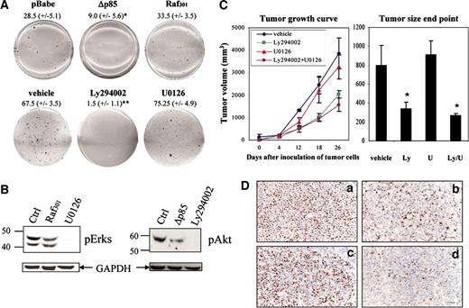 Fig. 1. Inhibition of phosphatidylinositol 3′-kinase pathway significantly reduces tumor growth of 1984-1 melanoma cells in vitro and in vivo. A, cells were seeded in soft agar with 0.01% DMSO (vehicle alone), 10 μm Ly294002, 10 μm U0126, or 1 μm 4-hydroxytamoxifen for activation of the Raf301 construct. Average numbers of colonies ± SDs from three independent experiments are indicated. Differences between Ly294002 and vehicle-treated cells and Δp85- and pBabe-expressing cells are statistically significant (*, P < 0.05; **, P< 0.0001). B, protein lysates from 1984-1 cells treated with 0.01% DMSO, 50 μm Ly294002, or 10 μm U0126 and lysates from 1984-1 cells overexpressing the dominant negative constructs treated with 0.01% DMSO (Ctrl and Δp85) or 1 μm 4HT (Raf301) were screened with anti-phospho-p44/42 extracellular signal-regulated kinases, anti-phospho-Akt, and anti-glyceraldehyde-3-phosphate dehydrogenase (GAPDH) antibodies. C, tumor volume [(w2 × l) 0.52] was measured weekly after s.c. injection of 1984-1 cells in severe combined immunodeficient mice. Values are the means ± SE of six independent measurements. For the end point measurements (experiment 2, 40 days), statistically significant differences from the vehicle-treated tumors are indicated (∗, P < 0.05, Student’s t test). D, Ki-67 staining of 1984-1 tumors from severe combined immunodeficient mice: a, control; b, Ly294002; c, U0126; d, Ly294002 + U0126. Magnification, ×200; bar, 50 μm.