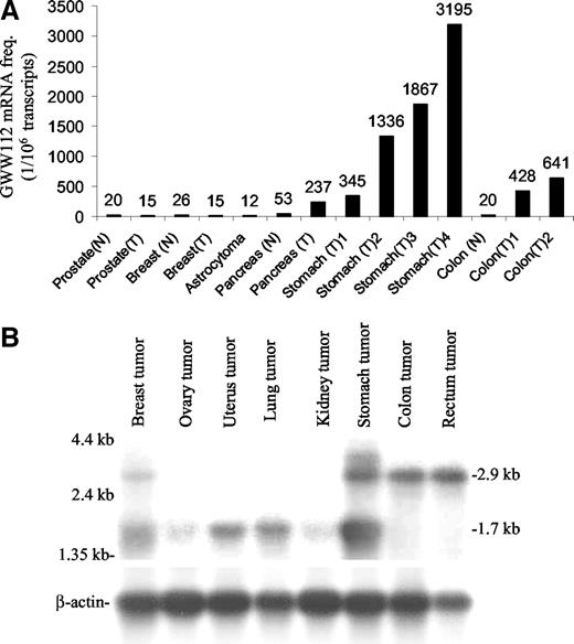 Fig. 1. Distribution of GW112 expression. A, a survey of GW112 expression in various normal and tumor tissues. The data were obtained by use of serial analysis of gene expression database available at the National Center for Biotechnology Information. N, normal tissue; T, tumor tissue. B, commercially acquired premade multiple tissues Northern blots (MTN, from Clontech Corporation) were probed with 32P-labeled GW112 and β-actin probes. There was ∼10 μg of total RNA per lane, derived from eight human tumor cell lines. The top panel shows results from GW112 probe, whereas the bottom panel shows results from β-actin cDNA probe