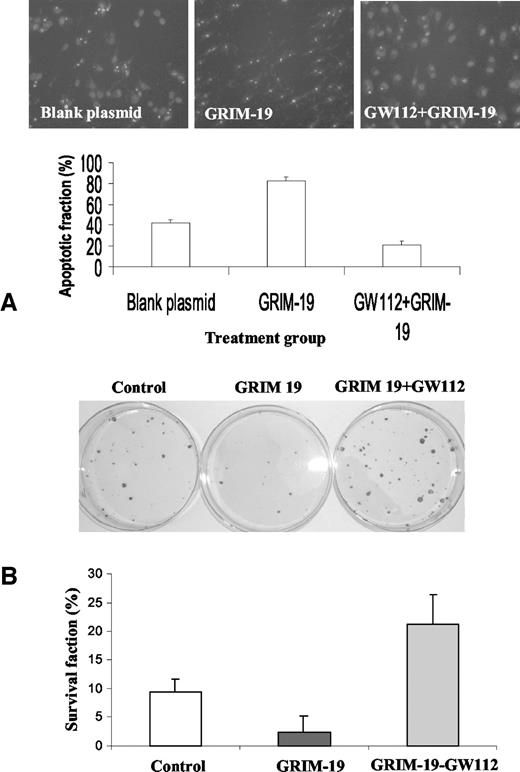 Fig. 5. Attenuation of IFN-β/RA-induced cell death by GW112. A, GW112-mediated attenuation of apoptosis in HeLa cells. Top panel shows typical photomicrographs of cells under different conditions. The bottom panel shows results of quantitative analysis of the extent of apoptosis in different cell populations; bars, ±SD among data obtained from three independent Petri dishes with the same treatment. Student’s t test was used to determine the P. B, GW112 mediated increase in long-term cellular survival after IFN-β/RA treatment. HeLa cells were transfected with pCMV-Tag-2B blank plasmid as a control; pCMV-GRIM-19, pCMV-GRIM-19, and pCMV-GW112.