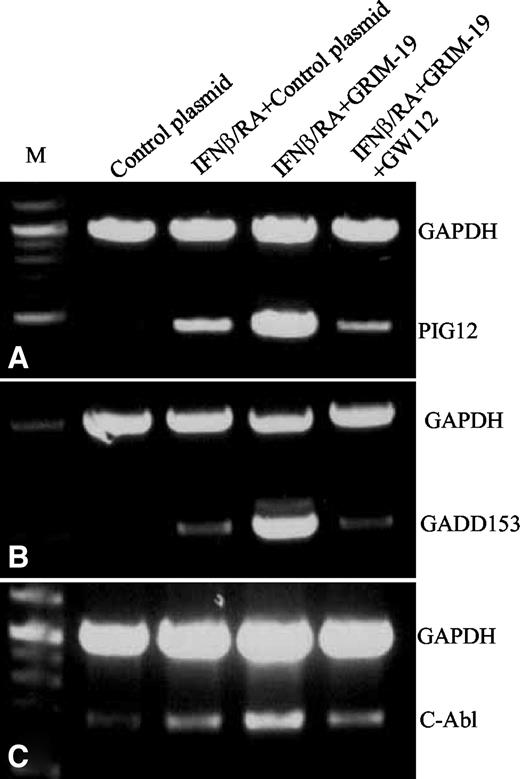Fig. 6. Semiquantitative analysis of the effects of GW112 and GRIM-19 on IFN-β/RA-induced apoptotic gene expression in HeLa cells. Messenger mRNA from various cell populations were reverse-transcribed into cDNA. The cDNA were then amplified by gene-specific PCR. A, the lower band is a PCR-amplified 480 bp PIG12 gene fragment. B, the lower band shows a PCR-amplified 512 bp GADD153 gene fragment. C, the lower band shows a PCR-amplified 671 bp c-Abl gene fragment. The top bands in all three panels show the coamplified 1 kb fragment of GAPDH gene.
