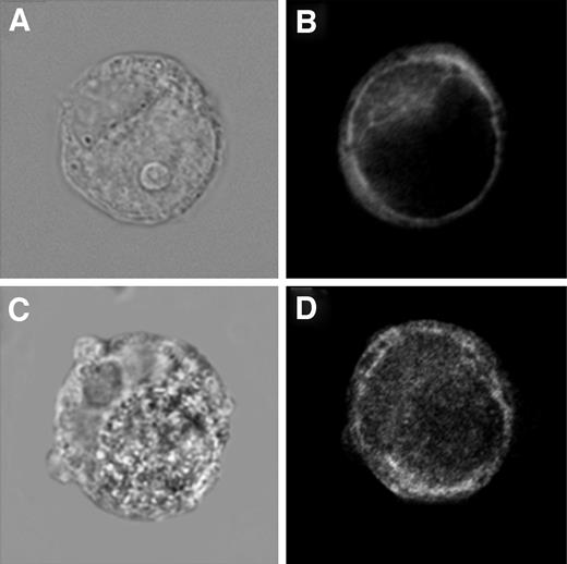 Fig. 1. Immunofluorescence staining of T-type Ca2+ channels and transient receptor potential 1 cation channels of HT1080 cells. Adherent HT1080 cells were fixed with glutaraldehyde and then labeled with rabbit anti-T-type Ca2+ channel polyclonal antibody (2 μg/ml; A and B) or rabbit antitransient receptor potential 1 cation channel polyclonal antibody (2 μg/ml; C and D), respectively, followed by labeling with a tetramethylrhodamine isothiocyanate-conjugated goat antirabbit antibody (1 μg/ml). Representative differential interference contrast microscopy (A and C) and deconvoluted z-scan fluorescence (B and D) images are shown. Although the T-type channels are largely distributed randomly at the cell periphery, the transient receptor potential 1 channels are found to have a more punctate distribution about the periphery (n = 3; ×980).