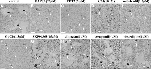 Fig. 5. Effect of Ca2+ channel blockers on HT1080 motility. A suspension of HT1080 cells with or without calcium channel blockers was seeded onto gold-coated coverslips. Brightfield microscopy was performed after incubation at 37°C. The extent of cell motility is indicated by the amount of neighboring area cleared by the cells. An untreated cell is shown in A. Control experiments using treatment with the intra and extracellular Ca2+ chelators BAPTA (25 μm; B) and EDTA (5 mm; C) showed an absence of cell motility. Treatment with carboxyamido-triazole (CAI; 10 μm; D), mibefradil (1.5 μm; E), or Gd3+ (1.5 μm; F) significantly reduced HT1080 area cleared by the cells. However, SKF96365 (15 μm; G), diltiazem (1 μm; H), verapamil (4 μm; I), and nicardipine (1 μm; J) had no effect on cell migration (n = 3; ×80).