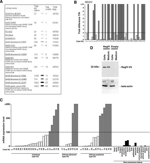 Fig. 4. A, Virtual Northern analysis shows REGIV expression to be narrowly restricted. Poorly differentiated gastric cancer (GC G189) showed strong expression of REGIV, whereas moderately differentiated GC (GC G234) did not. In our SAGE analysis, REGIV expression was detected as follows: 1933 in S219T; 714 in W246T; 1105 in P208L; 113 in W226T; and 259 in P208T. B, quantitative RT-PCR analysis of REGIV in primary GC and corresponding nonneoplastic mucosa. Fold change indicates the ratio of REGIV mRNA level in GC to that in corresponding nonneoplastic mucosa. Of the 46 GC samples, overexpression (T/n > 2) of REGIV was identified in 22 (47.8%). C, quantitative RT-PCR analysis of REGIV in primary GC samples and various noncancerous tissues. In GC, a high level of REGIV expression (>100 arbitrary units) was identified in samples 31, 9, 33, 14, 30, 18, 27, 45, 21, 7, 15, 22, 16, and 46. In various noncancerous tissues, a high level of REGIV expression was not identified. REGIV expression was found in noncancerous stomach, duodenum, ileum, colon, and pancreas. The units are arbitrary, and we calculated REGIV mRNA expression by standardization to 1.0 μg of total RNA from HSC-39 as 1.0. D, anti-V5 Western blot assay of V5 epitope- tagged RegIV protein. Cells and media from MKN-28 cells transfected with pcDNARegIV-V5 (RegIV) or pcDNA 3.1 (empty) constructs were lysed, resolved by SDS- PAGE, and immunoblotted with monoclonal mouse anti-V5 antibody. We confirmed by anti-β-actin Western blot that contamination of cells in culture medium was minimal.