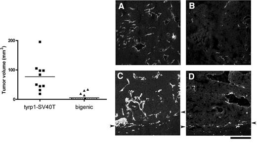 Fig. 5. Secondary brain tumors in tyrp1-Tag and bigenic mice. Left panel, the figure represents the distribution of tumor volumes (mm3) from 11 tumors from tyrp1-Tag mice and from 19 tumors from bigenic mice. Tumor volume was calculated from tumor sections at medial part as indicated in “Materials and Methods.” The mean is indicated as a horizontal line for each group (Tyrp1-Tag, 69.48 ± 14.6 mm3; bigenic tumor volumes, 0.37 ± 0.5 mm3; P < 0.0001). Right panel (A–D), visualization of blood vessels in secondary brain tumors from tyrp1-Tag and bigenic mice. The sections are stained with anti-CD31 as indicated in “Materials and Methods.” A, tumor center, tyrp1-Tag; B, tumor center, bigenic; C, tumor periphery, tyrp1-Tag; D, tumor periphery, bigenic. Tumor margins are indicated with arrowheads. Scale bar = 100 μm.