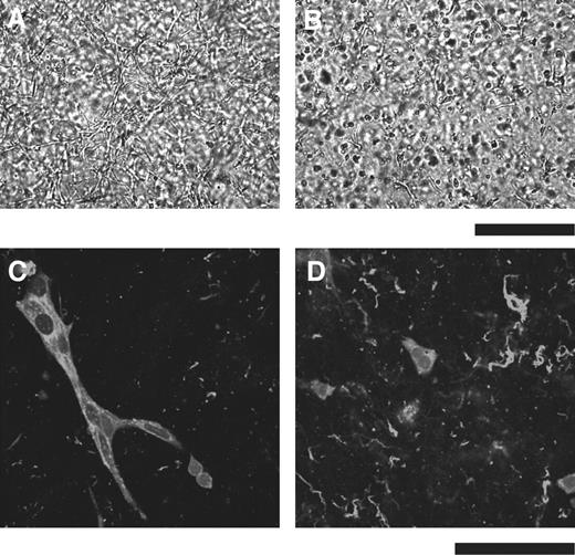 Fig. 6. Angiogenesis in vitro in cocultures of endothelial cells with tyrp1-Tag or bigenic tumor cells. Tumor cells from tyrp1-Tag or bigenic mice were cocultured with BCEs as described in “Materials and Methods.” After 48 h, microphotographs (A and B) were taken or cultures were stained with biotinylated BS-1 isolectin (C and D) and visualized as indicated in “Materials and Methods.” A and C, tyrp1-Tag; B and D, bigenic cultures. Scale bar in A and B = 500 μm and in C and D = 100 μm.