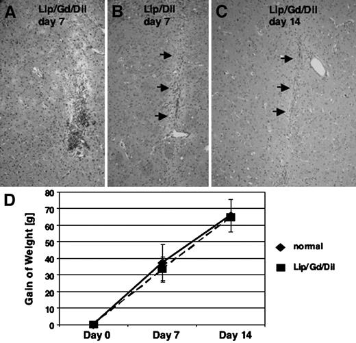 Fig. 4. Toxicity analysis. A−C, H&E stainings of paraffin sections (magnification, ×50). Five rats received a 20-μl infusion of Lip/Gd/DiI-DS into the right hemisphere and a 20-μl infusion of Lip/DiI-DS into the left hemisphere. After 7 days of infusion, inflammation noted in the brain receiving Lip/Gd/DiI-DS (A) was a little greater than inflammation of the brain receiving Lip/DiI-DS (B); however, the only inflamed tissue was adjacent to the needle tract and was resolving after 14 days (C). Arrow shows the needle tract found in these sections. D, gain in body weight of the rats receiving Lip/Gd/DiI-DS and Lip/DiI-DS infusions was compared with that of intact normal rats (data point: n = 5 for day 7; n = 3 for day 14).