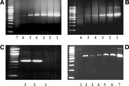 Fig. 2. Application of single-gene iFLP in detecting genomic instability-produced mutations. A, selectivity of iFLP for a p53 fragment; dilutions of mutation-positive (SW-480) into negative (HOS) DNA. Lanes 1–7, MF of 1, 10−2, 10−3, 10−4, 10−5, 10−6, and 0, respectively. B, similar to A, but iFLP was applied for an HPRT gene fragment. Lanes 1–6, MF of 10−2, 10−3, 10−4, 10−5, 10−6, and 0, respectively. C, single-gene iFLP applied to the HPRT gene for 6TG- treated DLD-1 cells. Lanes 1–3, SW-480 cells (mutation negative), 6-TG-selected DLD-1 cells, and mutation-positive control, respectively. D, single-gene iFLP applied to the HPRT gene for non-6TG-treated DLD-1 or SW-480 cells, and dilutions of mutation positive into mutation negative. Lanes 1–7, SW-480, DLD-1, MF of 10−6, 10−5, 10−4, 10−3, and 10−2, respectively.