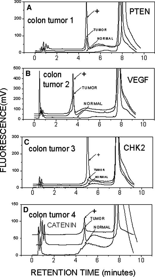 Fig. 5. Colon cancer and normal tissue surgical samples examined via genome-wide iFLP. Typical chromatograms are depicted from four gene segments indicating mutations in four colon cancer/normal tissue specimens (chromatograms A–D, gene segments PTEN, VEGF, CHK2, and β-catenin, respectively). Mutation-positive controls (+) for each gene segment diluted 100-fold for A, B, and D and 1000-fold for C and run under same conditions to indicate the retention times expected if mutations are present are also depicted. Experiments were repeated three times.
