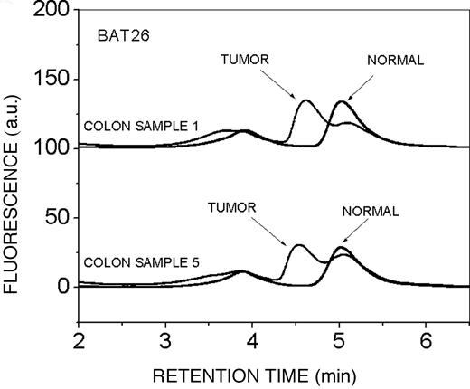 Fig. 7. dHPLC-based detection of MSI. Representative shifts in the chromatograms between tumor and normal tissue are depicted for the mononucleotide marker BAT26 in colon samples 1 and 5. a.u., arbitrary units.