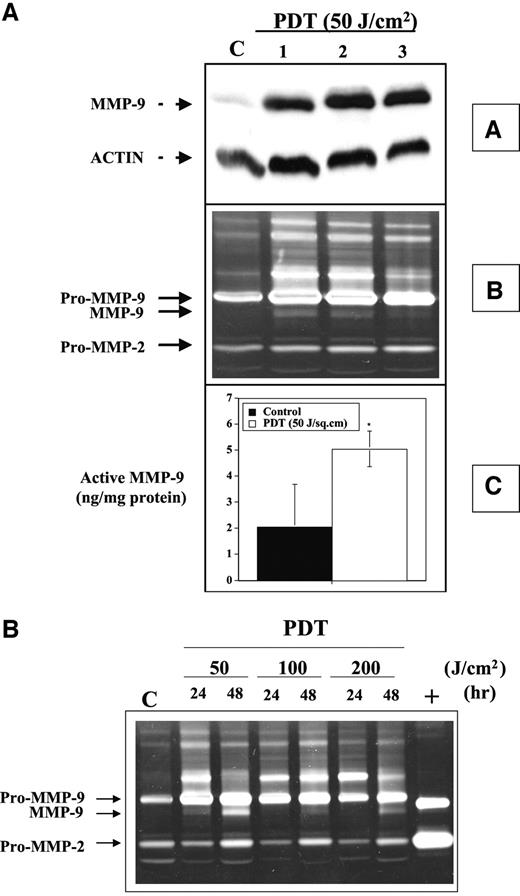 Fig. 1. Photodynamic therapy (PDT) induces expression and activation of matrix metalloproteinase (MMP)-9 in BA mammary tumors. A, mice received a 5-mg/kg i.p. injection of Photofrin porfimer sodium (PH) and 24 h later, tumors were treated with a 50-J/cm2 dose of 630 nm light. Tumor samples were collected 24 h after PDT and were evaluated by Western immunoblot (A, panel A), SDS-polyacrylamide gelatin zymography (A, panel B), or an ELISA MMP-9 activity assay (A, panel C). Values in panel C are the means ± SE for three separate animals; ∗, statistically significant differences were observed in active MMP-9 values between control and PDT (P < 0.05). B, gelatin zymography documenting the presence of MMP-2 and MMP-9 in tissue lysates from PDT-treated tumors. Tumor samples were collected 24 h or 48 h after PDT doses ranging from 50 to 200 J/cm2. Samples of serum-free conditioned medium from HT 1080 cells served as a positive control (+) for MMP-2 and MMP-9 expression.