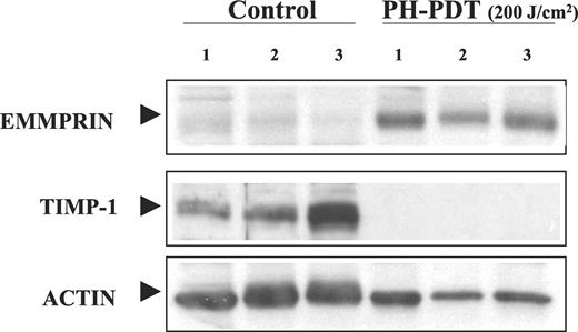 Fig. 2. Protein expression profiles of extracellular MMP inducer (EMMPRIN) and tissue inhibitor of metalloproteinase 1 (TIMP-1) are modulated in photodynamic therapy (PDT)-treated BA mammary tumors. Western immunoblot analysis showing expression of EMMPRIN, TIMP-1, and actin in tumors from three control and three PDT-treated mice. Tumor samples were collected 24 h after a 200 J/cm2 PDT dose. PH, Photofrin porfimer sodium.