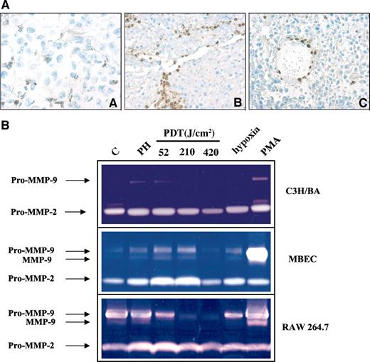 Fig. 3. Expression of matrix metalloproteinase (MMP)-9 in endothelial and infiltrating inflammatory host cells after photodynamic therapy (PDT). A, MMP-9 expression detected by immunohistochemistry in BA mammary tumor sections from control and PDT-treated mice. Animals received a 50-J/cm2 dose of PDT. Panel A, a section from an untreated tumor at ×63; panel B, a tumor section collected 6 h after PDT treatment at ×40; panel C, a tumor section collected 24 h after PDT treatment at ×40. B, gelatinase activity in serum-free medium from control and PDT-treated cultures of tumor cells (C3H/BA), endothelial cells [mouse brain endothelial cells (MBEC)], and macrophages (RAW 264.7). Samples were collected from control cells (C) after PH incubation or 24 h after PDT, hypoxia, or phorbol 12-myristate 13-acetate (PMA) treatments.