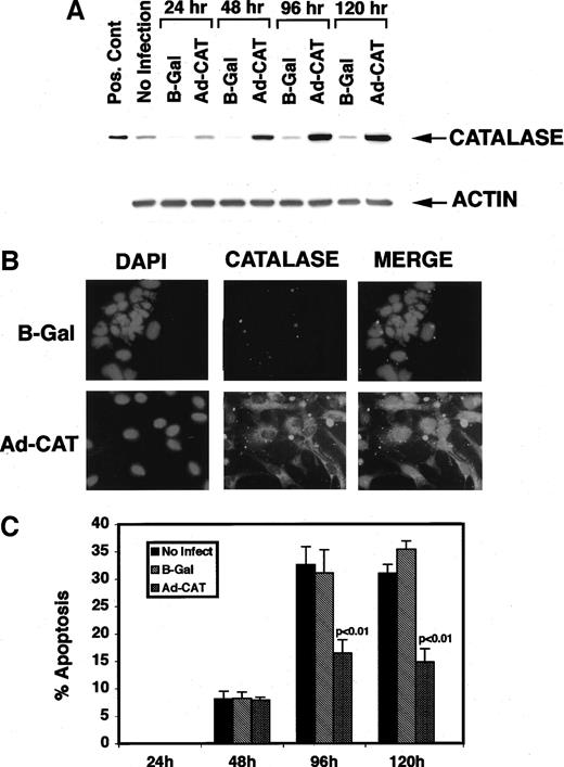 Fig. 5. Expression of CAT at different time points in TR9-7 cells following infection with Adeno-CAT expression vector or Adeno-βGAL control in the absence of tetracycline (A). Immunocytochemical staining of TR9-7 cells infected with either Adeno-CAT or Adeno-ΒGal control (B). CAT overexpressing cells show significant inhibition of apoptosis after 96 and 120 h.