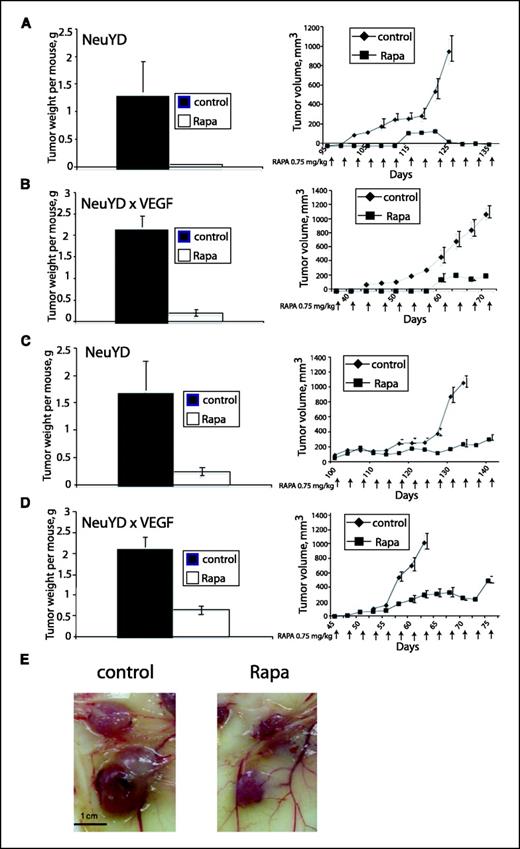 Figure 1. Antitumor activity of rapamycin. Mice were injected i.p. with vehicle only or with 0.75 mg/kg rapamycin (RAPA; 20 animals per treatment group) every other day. A, NeuYD mice were treated with the drug at day 38 postpartum before the emergence of palpable tumors. Tumor volumes were measured every other day, and tumors were excised at day 128 for control and day 138 for rapamycin-treated mice. Left, columns, mean of total tumor tissue weights in each treatment group; bars, SE. The effect of rapamycin on total tumor weight was highly significant (P < 0.0007) according to an unpaired t test. Right, tumor volume measurements during therapy. Arrows, days on which animals were injected with control vehicle or rapamycin. B, NeuYD × VEGF mice were treated and analyzed as described in (A). The drug effect on tumor weight in these mice was also significant (P < 0.001). C, NeuYD mice were treated with rapamycin after the appearance of palpable (∼5 mm) tumors. Total tumor mass was reduced by 81% in rapamycin-treated animals (P < 0.001). D, NeuYD × VEGF mice were treated with rapamycin after the emergence of palpable tumors. Total tumor mass was reduced by 63% in rapamycin-treated animals (P < 0.001). E, representative mammary tumors from control and rapamycin-treated NeuYD × VEGF mice.