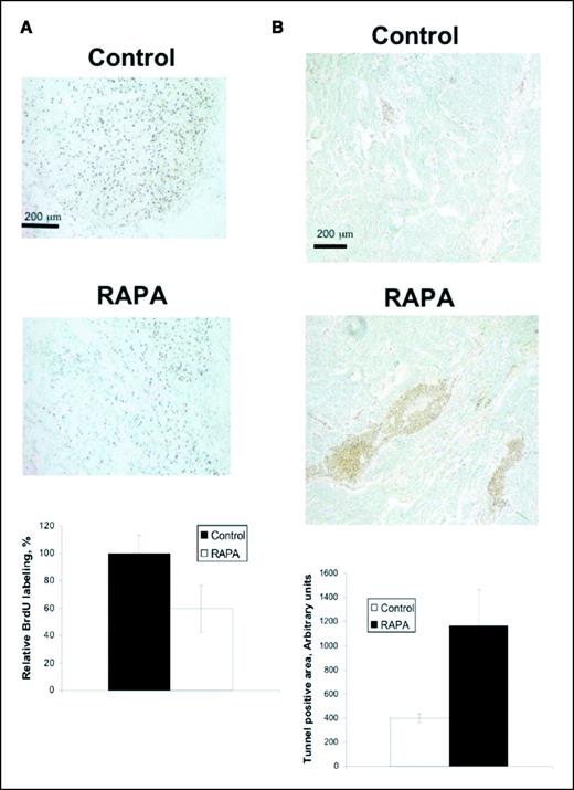 Figure 3. Effects of rapamycin on tumor cell proliferation and apoptotic death. A, DNA synthesis. NeuYD × VEGF mice bearing progressively growing mammary tumors were treated for 5 consecutive days with vehicle or 0.75 mg/kg rapamycin. At 4 hours after the last drug treatment, the mice were injected i.p. with 250 mg/kg BrdUrd. The mice were sacrificed after 2 hours, and the tumors were stained with BrdUrd-specific antibody to mark cells that were actively synthesizing DNA. Bottom, α-BrdUrd staining intensity was quantified in tumors from four mice in each treatment group. The decrease in BrdUrd incorporation into DNA in tumors from the rapamycin-treated mice was significant (P < 0.05). B, apoptotic cell death. Tumors from NeuYD mice treated with control vehicle or with rapamycin as described in Fig. 1 legend were analyzed for apoptotic cells by TUNEL staining. A representative section showing several islands of apoptotic cells (dark brown). Columns, mean TUNEL-positive area from three different tumor specimens in each treatment group; bars, SE.