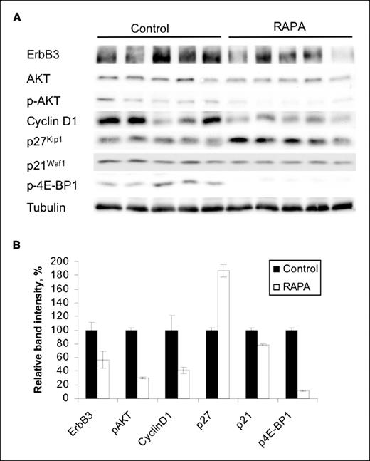Figure 4. Protein expression in NeuYD × VEGF tumors. A, NeuYD × VEGF mice were given a short course of rapamycin therapy as described in Fig. 3 legend. Tumor extracts were immunoblotted with the indicated antibodies. B, summary of protein expression results. Photographic films from protein immunoblots were subjected to quantitative densitometric analysis with NIH Image 1.63 software. The densitometric units obtained for each protein were normalized to those obtained with the tubulin control in each sample. The normalized densitometric units were then arbitrarily set to 100% for the control vehicle-treated samples. Columns, mean from five independent tumor specimens in each treatment group; bars, SE.