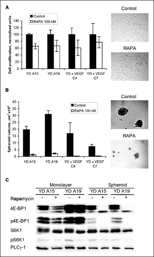 Figure 5. Effects of rapamycin on cell proliferation in two-dimensional versus three-dimensional cultures. A, tumor-derived cell lines were cultured as cell monolayers in plastic dishes in the presence or absence of 100 nmol/L rapamycin. After 4 days, cell proliferation was determined with a colorimetric assay. The absorbance values obtained in the control samples were arbitrarily set at 100%. Columns, mean from triplicate samples; bars, SD. Right, representative photomicrographs of control and rapamycin-treated cell cultures. B, the indicated cell lines were grown for 4 days as spheroids in Matrigel-coated dishes. Rapamycin (100 nmol/L) was added to the cultures, and the spheroids were examined after 4 additional days in culture. Spheroid dimensions were measured microscopically with an optical micrometer, and spheroid volumes were calculated as described in Materials and Methods. Right, representative photomicrographs of YD A15 spheroids from each treatment group. C, Western blot analysis of rapamycin target proteins in monolayer versus spheroid cultures. RIPA buffer extracts from the YD cell lines were separated by SDS-PAGE and immunoblotted with the indicated protein-specific or phosphospecific antibodies. Phospholipase Cγ1 (PLCγ1) levels were determined to control for sample loading.
