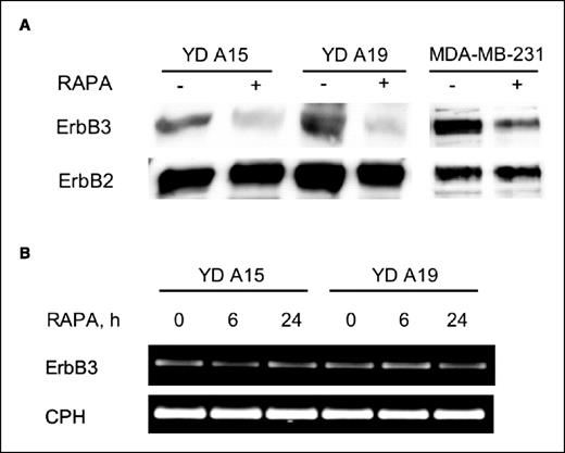 Figure 7. Effect of rapamycin on ErbB3 expression in breast cancer cell lines. A, NeuYD-derived cell lines and the human breast cancer cell line MBA-MD-231 were treated for 20 hours with 100 nmol/L rapamycin. Detergent-soluble proteins were separated by SDS-PAGE, and protein blots were sequentially probed with ErbB3- and ErbB2-specific antibodies. B, Q-PCR analysis. Cells were treated for 6 or 24 hours with 100 nmol/L rapamycin, and total RNA was isolated for Q-PCR analysis. Representative results from the linear region of the PCR amplification curves.