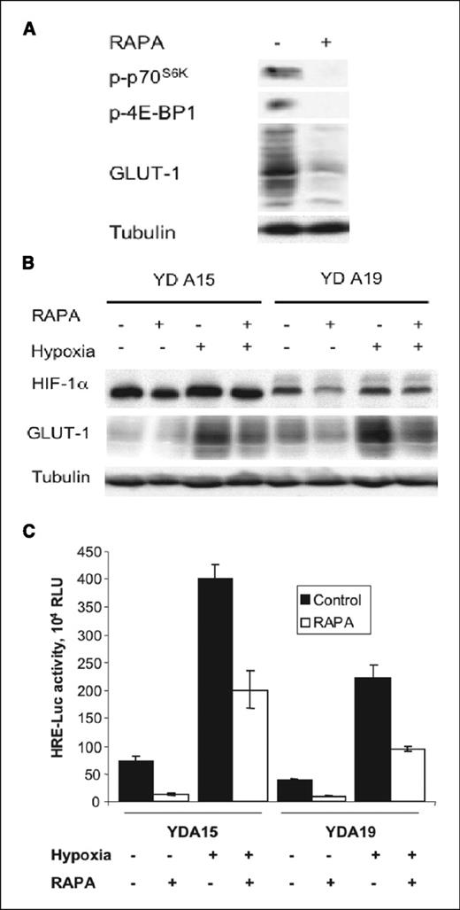 Figure 8. Effect of rapamycin on hypoxia-induced HIF-1 activation. A, extracts from NeuYD × VEGF mammary tumor were immunoblotted with the indicated antibodies. B, NeuYD A15 and A19 cells were cultured under normoxic or hypoxic (1% oxygen) conditions, and detergent extracts were immunoblotted with the indicated antibodies. C, cells were transiently transfected with a HIF-1-responsive luciferase reporter plasmid (pHRE-Luc). At 24 hours post-transfection, the cells were cultured in low-serum (0.1% fetal bovine serum) medium. After 8 hours, the indicated samples were pretreated for 30 minutes with 100 nmol/L rapamycin and then cultured for 16 hours under normoxic or hypoxic conditions. Luciferase assays were done. Columns, mean relative light units (RLU) from triplicate samples; bars, SD.