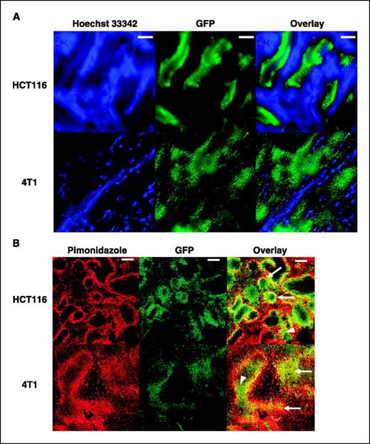 Figure 2. Validation of hypoxia-induced GFP expression in reporter-transduced HCT116 and 4T1 tumor tissues. A, complementary spatial distributions between GFP fluorescence (green) and Hoechst 33342 labeling (blue) are observed. Bar, 0.3 mm. B, concordant spatial distributions between pimonidazole staining (red) and GFP fluorescence (green) are observed. The majority of GFP+ areas were either colocalized with (arrows) or surrounded by (arrowheads) pimonidazole staining. Bar, 250 μm.