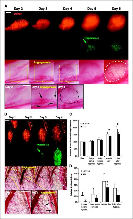 Figure 3. Incipient angiogenesis preceded hypoxic response in avascular tumors. A, representative window chamber images of HCT116 tumors revealing incipient angiogenesis (Day 3; black arrows) and its progress (Day 4; black dotted circle) preceded hypoxic response (Day 5; green arrow). In contrast, the secondary, more intensive angiogenesis appeared after hypoxic response (Day 6; white dashed circle). Bar, 0.3 mm. B, representative window chamber images of 4T1 reporter tumors revealing incipient angiogenesis (Day 2; black arrows) preceding hypoxic response (Day 3; green arrows). The secondary more intensive angiogenesis occurs after the hypoxic response revealing new vascular buds (Day 4; white dashed circle) sprouting toward hypoxic regions and absence of GFP fluorescence in most angiogenic tumor regions. Bar, 0.3 mm. C, relative tumor vascular length density before and after the hypoxia in HCT116 and 4T1 window chamber tumors (n = 5 for HCT116 tumors; n = 7 for 4T1 tumors; t test, *P < 0.05). Columns, mean; bars, SE. D, relative angiogenic rate before and after onset of hypoxia in HCT116 and 4T1 window chamber tumors (n = 5 for HCT116 tumors; n = 7 for 4T1 tumors; t test, *P < 0.05). Columns, mean; bars, SE.
