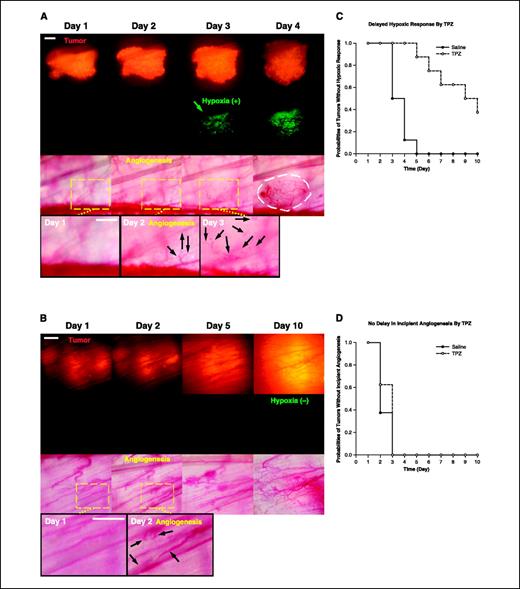 Figure 4. Suppression of hypoxic response by selectively killing hypoxic cells does not delay incipient tumor angiogenesis. A, representative window chamber images of a saline-treated HCT116 tumor revealing the incipient angiogenesis (Day 2; black arrows) before the hypoxic response (Day 3; green arrow). Endothelial cords and sprouts surrounding the hypoxic region (Day 3; black arrows) developed into a vascular plexus (Day 4; white dashed circle). Bar, 0.3 mm. B, representative window chamber images of a tirapazamine-treated HCT116 tumor revealing incipient angiogenesis (Day 2; black arrows) and its development into a vascular plexus (Day 10; white field) in the absence of hypoxic response (no GFP fluorescence). Bar, 0.3 mm. C, probabilities of time required for the initial hypoxic response in tirapazamine versus saline-treated HCT116 window chamber tumors. Tirapazamine treatment significantly delayed the initial hypoxic response when compared with saline treatment (median time: 9.5 days in the tirapazamine-treated group versus 3.5 days in the saline-treated group; Kaplan-Meier analysis, n = 8, log-rank test, P < 0.001). D, probabilities of times required for onset of incipient angiogenesis in tirapazamine versus saline-treated HCT116 window chamber tumors. No significant difference was found between tirapazamine treatment and saline treatment (Kaplan-Meier analysis, n = 8, log-rank test, P = 0.33). E, representative window chamber images of a saline-treated 4T1 tumor revealing incipient angiogenesis (Day 2; black arrows) before the hypoxic response (Day 4; green arrow). Bar, 0.3 mm. F, representative window chamber images of a tirapazamine-treated 4T1 tumor revealing incipient angiogenesis (Day 3; black arrows) before the hypoxic response (Day 7; green arrow). Bar, 0.3 mm. G, probabilities of the time required for the initial hypoxic response in tirapazamine versus saline-treated 4T1 window chamber tumors. Tirapazamine treatment significantly delayed the initial hypoxic response when compared with saline treatment (median time: 5.5 days in the tirapazamine-treated group versus 4 days in the saline-treated group; Kaplan-Meier analysis, n = 8, log-rank P < 0.05). H, probabilities of time required for incipient angiogenesis in tirapazamine versus saline-treated 4T1 window chamber tumors. No significant difference was found between tirapazamine and saline treatment (Kaplan-Meier analysis, n = 8, log-rank P = 0.66). I, VEGF levels in the culture media of HCT116 and 4T1 cells treated with hypoxia versus normoxia. Hypoxia significantly stimulates VEGF secretion (n = 6, t test, *P < 0.001). Columns, mean; bars, SE. Notably, both cell lines secrete low levels of VEGF under normoxic conditions.