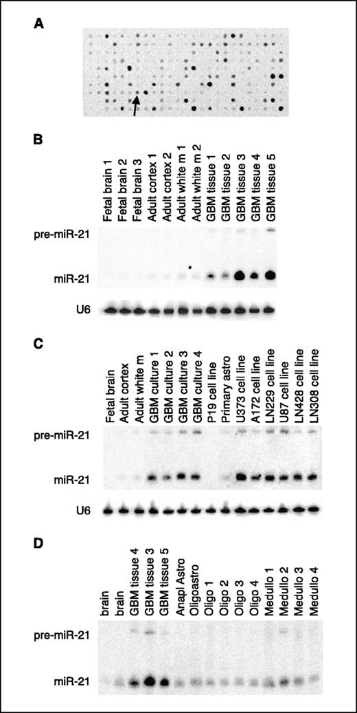 MicroRNA-21 Is an Antiapoptotic Factor in Human Glioblastoma Cells ...