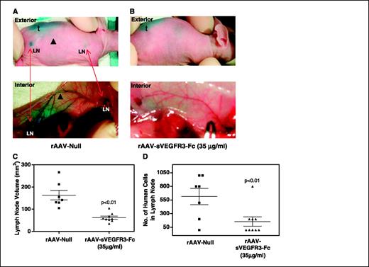 Figure 3. rAAV-sVEGFR3-Fc inhibits lymph node metastasis in a s.c. Caki-2 model. Immunodeficient mice were challenged s.c. with Caki-2 tumor cells 10 days following rAAV-sVEGFR3-Fc or rAAV-Null vector administration. Two weeks following tumor challenge, randomly selected mice were injected intratumorally with 1% isosulfan blue for lymphatic vessel mapping (A and B). A typical observation of blue dye draining through enlarged lymphatic vessels from the tumor to the lymph nodes in rAAV-Null–injected Caki-2 tumor-bearing mice (A), which was absent in the rAAV-sVEGFR3-Fc–treated animals (B). t, s.c. tumor injected with 1% isosulfan blue; LN, isosulfan blue-stained lymph nodes; filled arrow, isosulfan blue–stained lymphatic vessel. C, mean ± SE volume of axillary and inguinal lymph nodes harvested from control and treated mice. D, mean ± SE number of human metastatic tumor cells present in the lymph nodes of control and treated mice as determined by PCR analysis using specific human genome (alu) sequence probes.