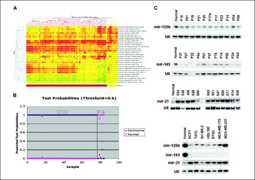 Figure 1. Cluster analysis and PAM prediction in breast cancer and normal breast tissues. A, tree generated by a cluster analysis showing the separation of breast cancer from normal tissues on the basis of miRNA differentially expressed (P < 0.05) between breast cancer and normal tissue (see Supplementary Table S1). The bar at the bottom indicates the group of cancer samples (red) or the group of normal breast tissues (yellow). B, PAM analysis displaying the graphical representation of the probabilities (0.0-1.0) of each sample for being a cancer or a normal tissue. All breast cancer and normal tissues were correctly predicted by the miR signature shown in Table 1. C, Northern blot analysis of human breast carcinomas and breast cancer cell lines with probes mir-125b, mir-145, and mir-21. The U6 probe was used for normalization of expression levels in the different lanes.