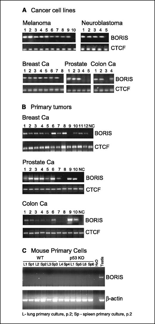 Figure 1. Aberrant reactivation of BORIS in various cancer cell lines and primary tumors. A, multiple cancer cell lines show expression of BORIS mRNA by RT-PCR. Lanes are marked according the type of cancer: melanoma (lanes 1-10): SK-MEL-5, MALME-3M, SK-MEL-2, SK-MEL-28, Godowns-MEL, 624.28-MEL, 928-MEL, 1359-MEL, A375, and 1123-MEL; neuroblastoma (lanes 1-5): SK-N-D2, GoTo, SK-N-SH, SK-N-DZ, and NBL-W; breast cancer cell lines (lanes 1-8): Du4475, CAMA-1, T47D, MDA231, MDA435, MDA453, ZR75-1, and MCF7; prostate cancer (lanes 1-5): Vcap, DuCap, TP2, Du145, and PC3; colon cancer (lanes 1-4): Colo320 HSR, DLD1, SW48, and Colo205. B, representative examples of abnormal BORIS activation in random samples of primary breast, prostate, and colon tumors and lack of activation in corresponding normal control tissues (lane NC). C, activation of BORIS does not occur as an adaptation to tissue culture conditions. Representative lung and spleen tissue samples from three healthy adult wild-type and p53 knockout mice have been used for preparing primary cell cultures grown for 1 week under standard conditions.
