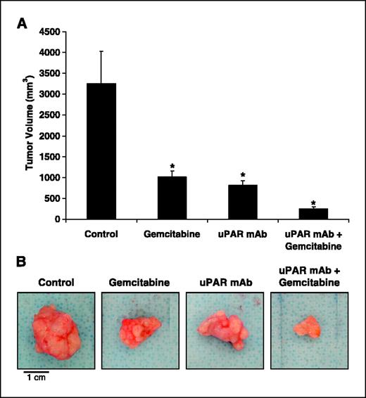 Figure 3. Effect of anti-uPAR antibody and gemcitabine on pancreatic tumor volume. L3.6pl cells were injected into the pancreatic tails of nude mice. Treatment with nonspecific IgG plus saline (control), gemcitabine, anti-uPAR mAb, or anti-uPAR mAb plus gemcitabine was begun on day 4 and continued until mice were sacrificed on day 28. A, gemcitabine alone inhibited orthotopic tumor growth, as expected. Anti-uPAR mAb alone also significantly inhibited tumor growth, and anti-uPAR mAb plus gemcitabine was better than either agent alone. *, P < 0.05 versus control; columns, means of 11 to 13 tumors per group; bars, SE. B, representative photographs of pancreatic tumors.