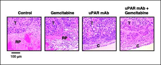 Figure 4. Effect of anti-uPAR antibody and gemcitabine on retroperitoneal tumor invasion. Photographs demonstrating retroperitoneal invasion by tumors treated with nonspecific IgG plus saline (control), gemcitabine, anti-uPAR mAb, or anti-uPAR mAb plus gemcitabine. Pancreatic tumor cells invaded the retroperitoneum in the control and gemcitabine-alone groups, whereas there was no retroperitoneal invasion and tumor capsules remained intact in the groups treated with anti-uPAR mAb and anti-uPAR mAb plus gemcitabine. T, tumor; RP, retroperitoneum; C, tumor capsule.