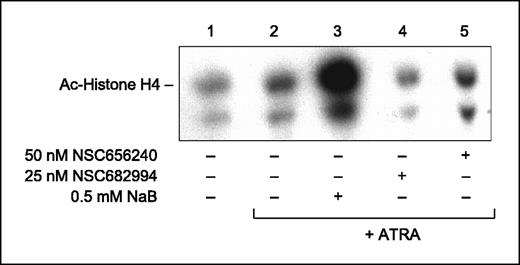 Figure 7. Effects of benzodithiophene analogues on acetylation of histone H4. NB4 cells were incubated with benzodithiophene analogues and ATRA for 24 hours. The levels of histone acetylation were assessed by Western blot using an anti–acetyl-histone H4 antiserum.