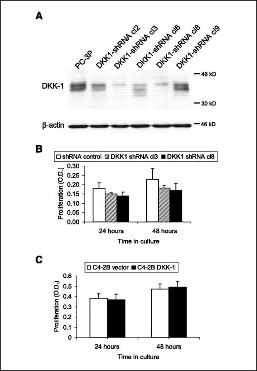 Figure 2. Reduction of DKK-1 protein expression in osteolytic PC-3 human prostate cancer cells by shRNA. PC-3 prostate cancer cells (PC-3P) were transfected with DKK-1 shRNA expression or control shRNA vectors using calcium phosphate and individual clones isolated. A, top, 30 μg of total protein from several clones were resolved on 10% reducing SDS-PAGE, transferred to polyvinylidene difluoride membrane, and blotted with goat anti-human DKK-1 antibody. Bottom, blots were stripped and reprobed with antiserum to human β-actin. B, cell proliferation was determined in the indicated DKK-1 shRNA–transfected PC-3 cell lines. Cells were plated in 96-well plates at a density of 1.5 × 103 cells per well and incubated for the indicated time. The total number of viable cells was determined using 3-(4,5-dimethyl-2-thiazolyl)-2,5-diphenyl-2H-tetrazolium bromide assay. Columns, means of two separate experiments. C, cell proliferation was determined in the indicated DKK-1-transfected C4-2B cell lines as described in (B). Columns, means of two separate experiments.