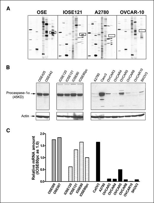Figure 1. Apoptosis-protein profiling, Western blot, and quantitative reverse transcription-PCR analysis of caspase-1 in OSE, IOSE, and ovarian cancer cells. A, immunoblot-based Kinexus KAPS apoptosis protein profiling assay showing the caspase-1α level (boxed bands) in OSE, IOSE, A2780, and OVCAR-10 cells. B, Western blot analysis of caspase-1α in OSE, IOSE, and ovarian carcinoma cell lines. Cells were cultured in medium 199/MCB105 with 10% fetal bovine serum. Cell lysates from different cell lines containing equal amounts of protein (30 μg) were loaded in each lane. C, relative amounts of caspase-1 mRNA quantitated by real-time PCR in two OSE (gray columns), four IOSE (dotted columns), and eight ovarian cancer cell lines (solid columns). rRNA (18S) primers and probes were used as an endogenous reference for quantitative reverse transcription-PCR amplification. Comparative Ct value calculation was carried out by setting the expression level of caspase-1 in IOSE80pc cells as 1.0.