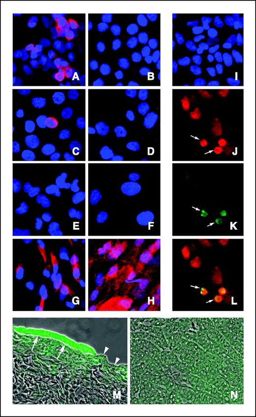Figure 2. Immunofluorescence and in situ cell death labeling. A-L, caspase-1α (red); nuclear fragmentation (TUNEL, green); Hoechst 33258 DNA (blue). A, CaOV3; B, OVCAR-3; C, OVCAR-5; D, OVCAR-8; E, OVCAR-10; F, SKOV3; G, OSE 424; H, OSE 355; I, A2780; J, A2780 cells transfected with caspase-1α; K, in situ labeling of apoptosis (TUNEL, green) in caspase-1α–transfected, overexpressing A2780 cells; L, merge of images (J) and (K) showing TUNEL-positive, caspase-1α–positive cells with fragmented nuclei (arrows), a typical apoptotic morphology; M, immunofluorescence staining of caspase-1 (green) in OSE (arrows) on the surface of a normal human ovary frozen section. Part of ovary without OSE (arrowheads); N, frozen section of a grade III ovarian carcinoma stained weakly for caspase-1 in comparison to OSE. M and N, merged fluorescent and phase contrast images of the same fields.