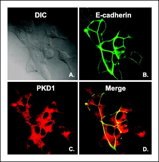Figure 1. E-cadherin colocalizes with PKD1 at cell junctions in LNCaP prostate cancer cells. Cells were cultured on glass coverslips, probed with PKD1 and E-cadherin antibodies (C-20 and 4A2), incubated with FITC and rhodamine-conjugated secondary antibodies and analyzed by laser scanning confocal microscopy (Carl Zeiss, Germany). A, DIC image of LNCaP cells; B, localization of E-cadherin (green); C, localization of PKD1 (red); D, merged images (from B and C) showing E-cadherin/PKD1 colocalization (yellow) at cell borders in LNCaP cells.
